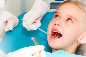 Caries en los dientes de leche